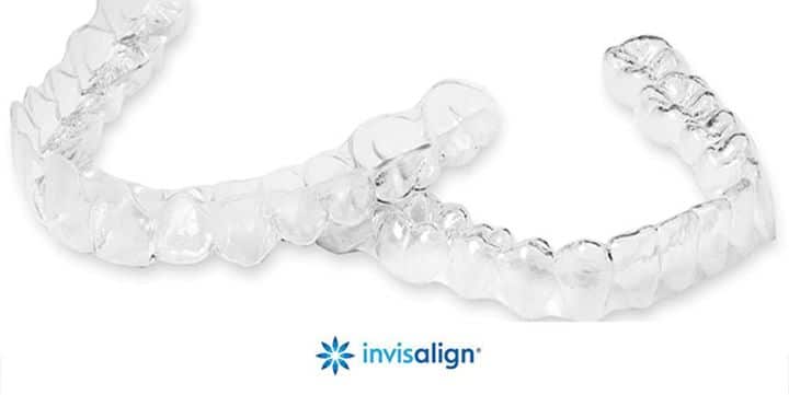 These are a depiction of what the clear aligners look like