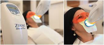 This is a photo of a patient receiving a Zoom! Whitening treatment.