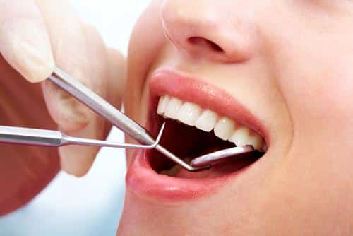 Dental Cleanings: Step-By-Step