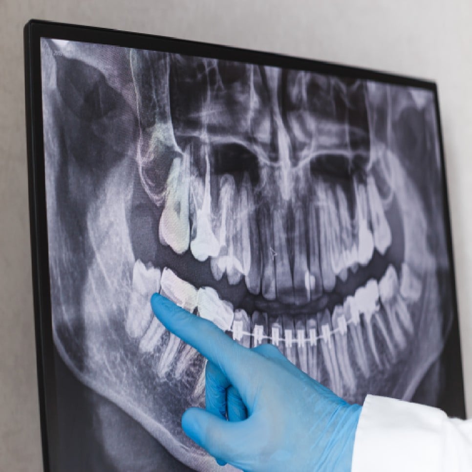_Dental X-Rays_