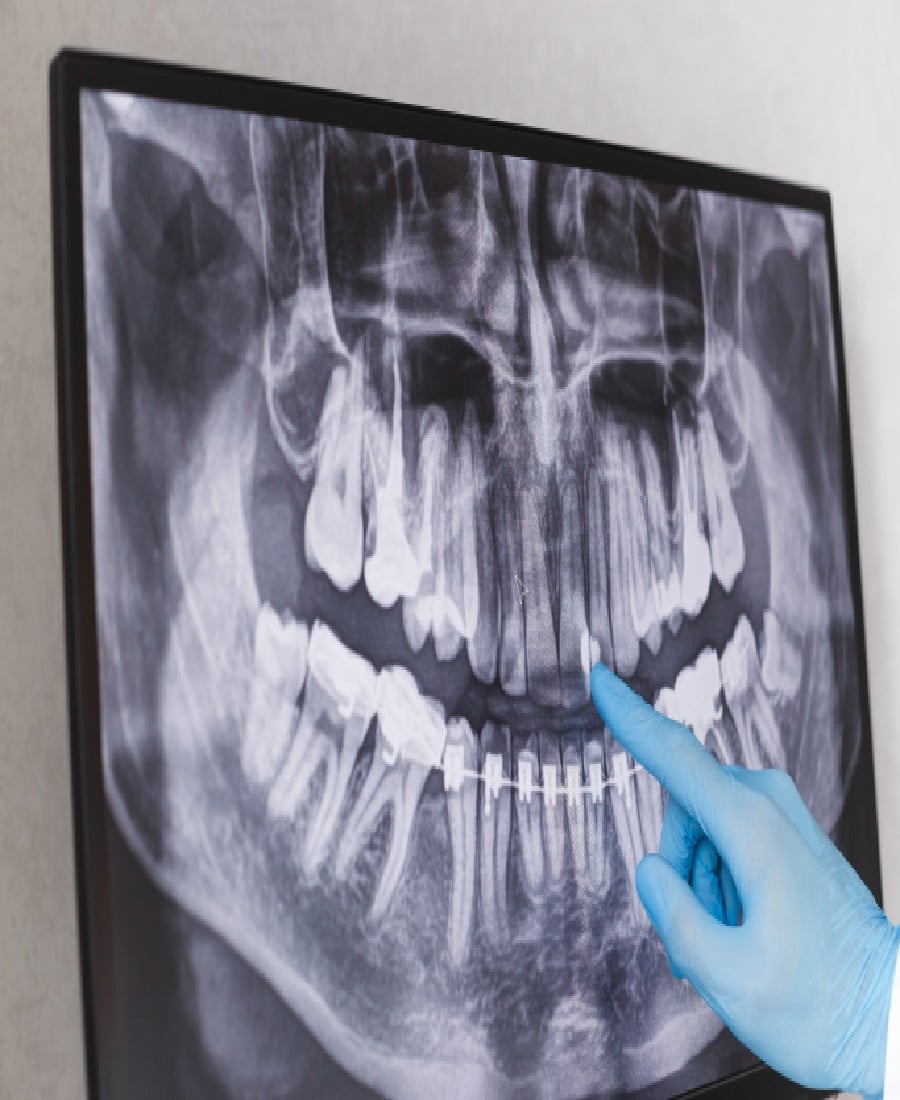 _Restorative Dentistry FAQs_