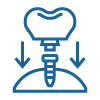 10 Reasons Dental Implants are Best