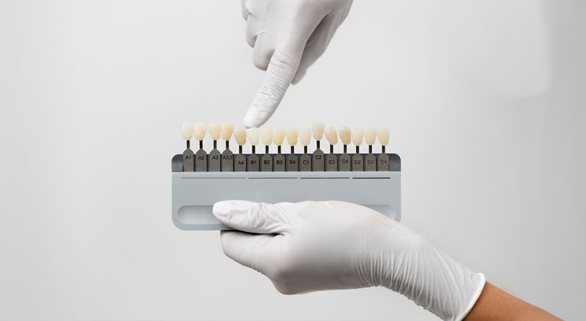 Everything to Know About Maintaining Porcelain Veneers